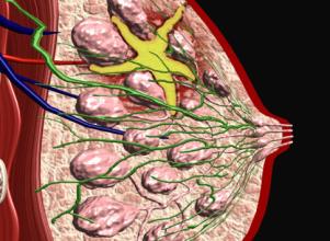 乳腺囊肿是怎么回事?